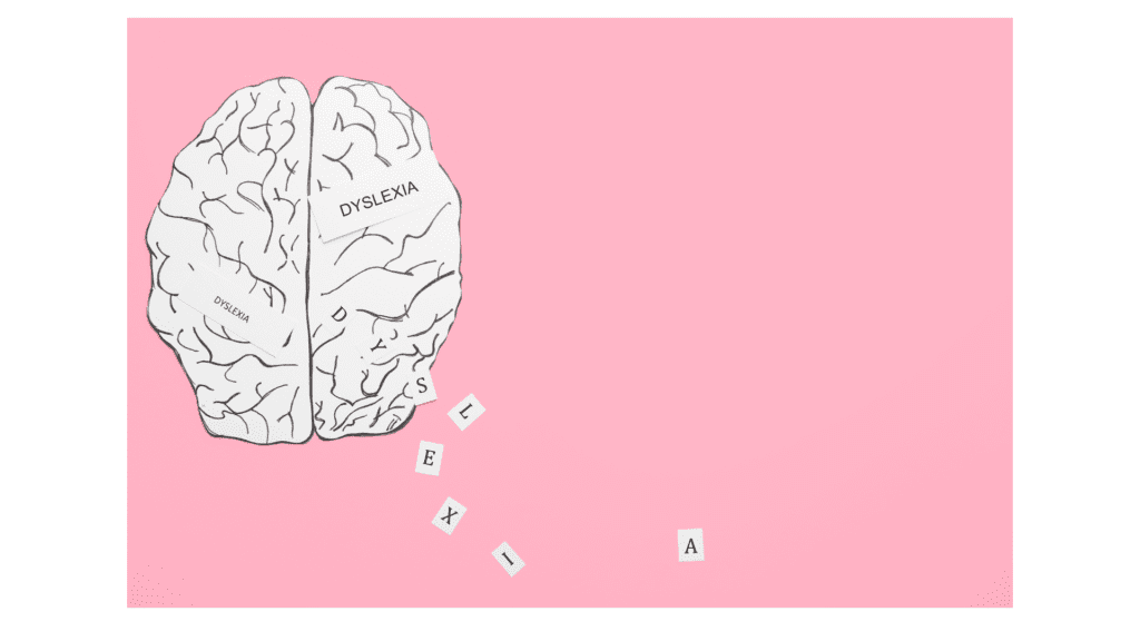 An illustration of a brain, showing the intricate network of neural connections and different regions of the brain.